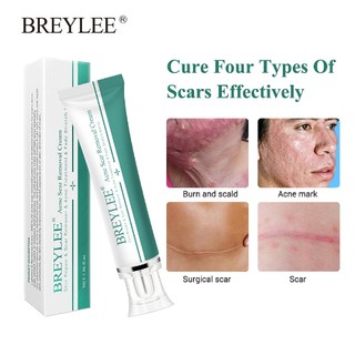 BREYLEE Acne Scar Removal Cream Skin Repair Skin Care Scar Acne Treatment Remove Stretch Marks Whitening Cream
