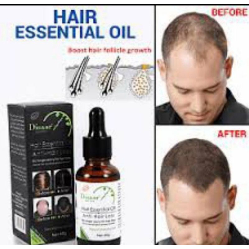 EXTREME ESSENTIAL HAIR OIL ANTI-HAIR LOSS HAIR GROWTH OIL SERUM 30ML ...