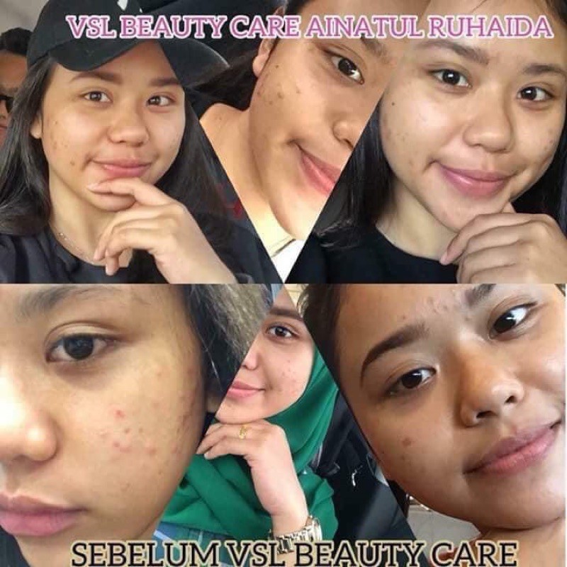 Buy Skin Care By V S L Beauty Care Seetracker Malaysia