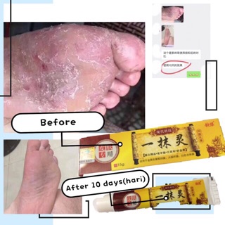 HOT SALES🔥现货READY STOCK🔥100% Genuine TJH 一抹灵  Shopee Malaysia