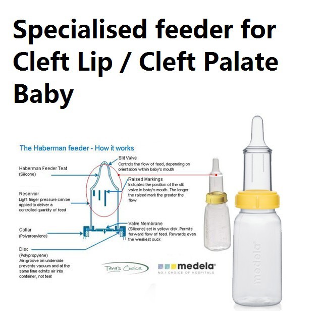 Haberman feeder best sale for cleft palate