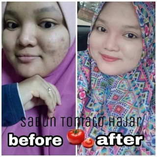 PROMOSI Hajar Skin Cleanser Original Sabun JERAGAT JERAWAT ...