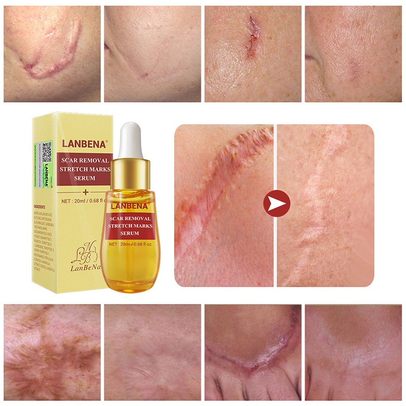 lanbena scar serum