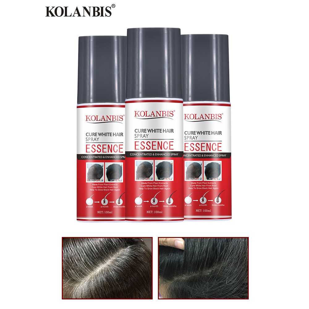 3 In SET Reduce White Hair Essence Spray Cure Gray Treatment Hair Scalp  Therapy Black Hair Care Hair Darkening Remedy | Shopee Malaysia
