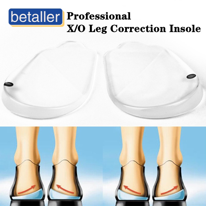 Leg Shape Corrector Oleg Xleg Orthopedic Heel Insoles Correct Foot