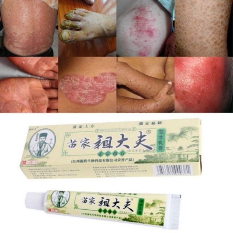 Buy Malaysian Seller Zudaifu Cream Skin Psoriasis Cream Fungal Seetracker Malaysia