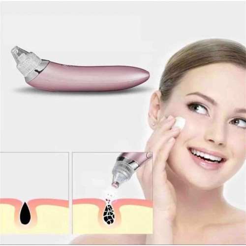 PORTABLE ULTRASONIC XN-8030 BLACKHEADS VACUUM REMOVER SUCTION CLEAN SKIN + FREE GIFT (BLACKHEAD REMOVER)