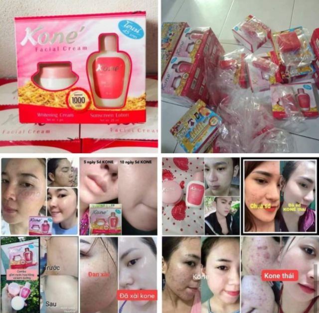 Original Kone Facial Cream Set Shopee Malaysia