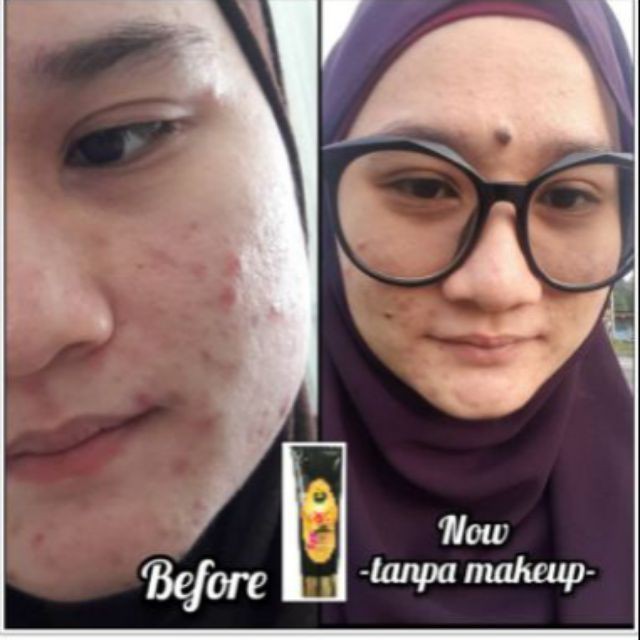 Ready Stock Mask Masker Kulit Kusam Oily Skin Kering Magic Tamarind Mask