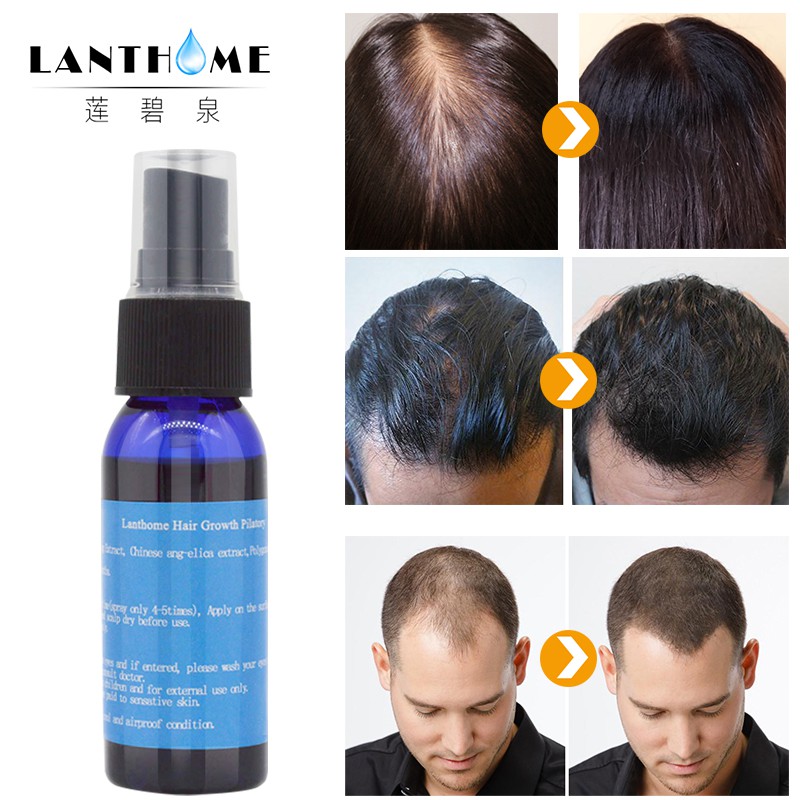 3pcs Unisex Hair Loss Treatment Hair Spray And Beard Regrowth