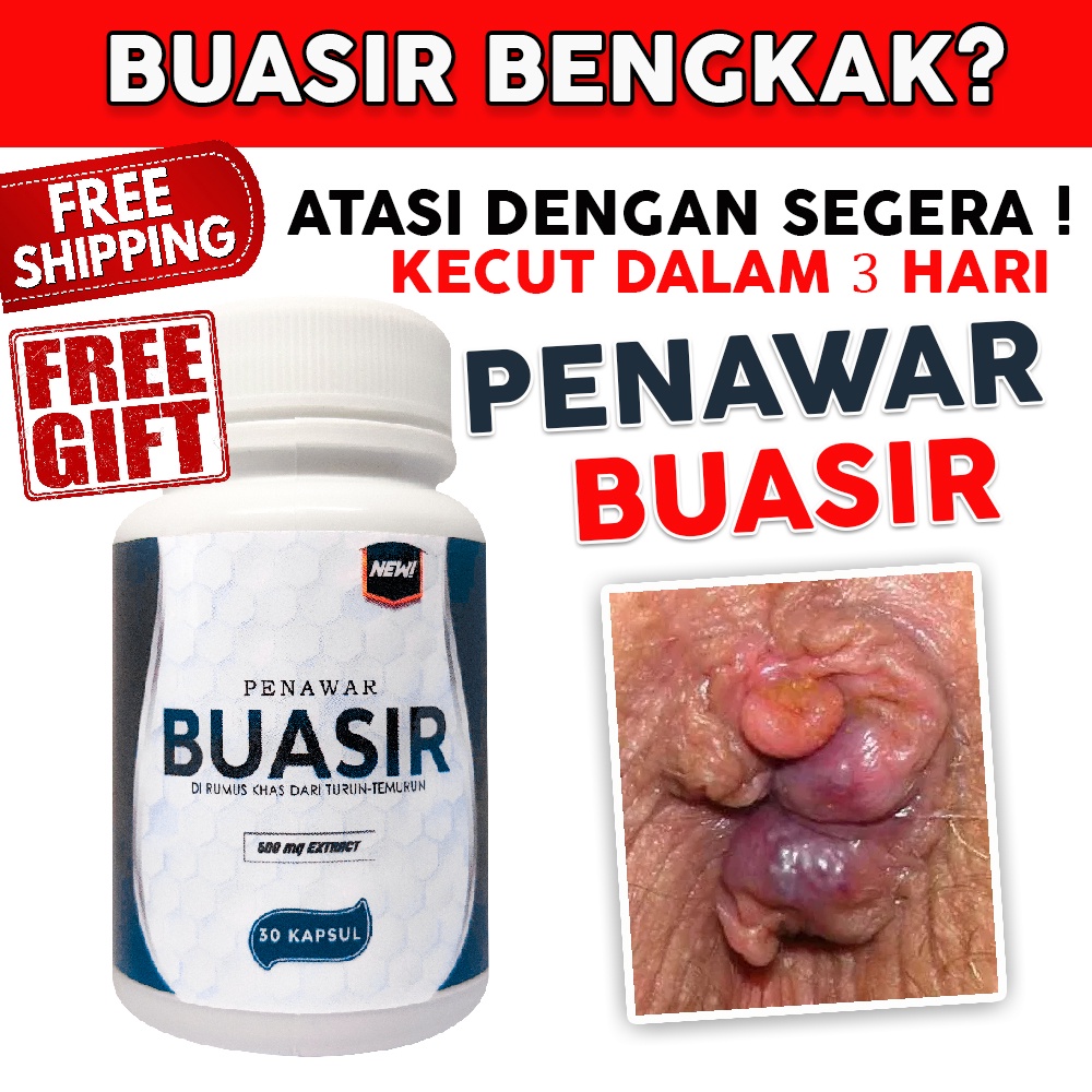 Ubat Buasir Penawar Buasir Ubat Bengkak Buasir Ubat Buasir Berdarah Sembelit Hemorroid Shopee Malaysia