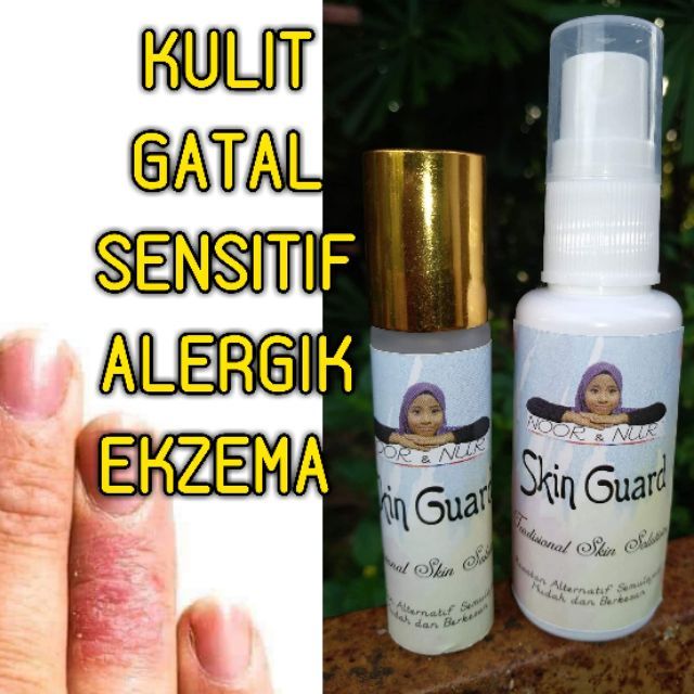 MINYAK herba ubat utk KULIT SENSITIF, ALERGIK, EKZEMA 