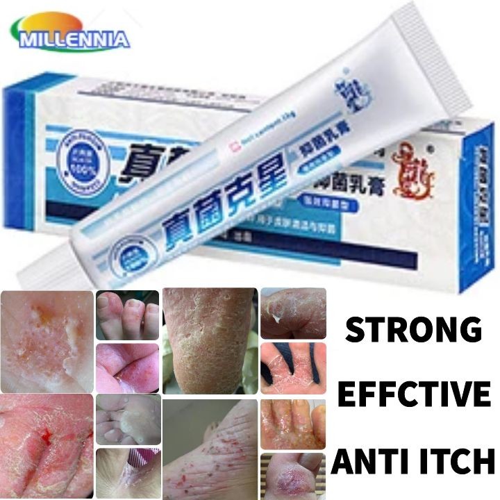 Ultra Strong Anti Fungal Anti Itch Relief Pain Tube Soft Cream Shopee