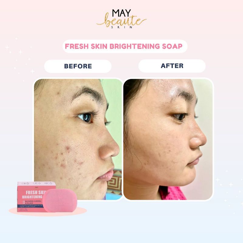 !!Ready!!Fresh Brightening soap with Niacinamide and Collagen 80gr ...