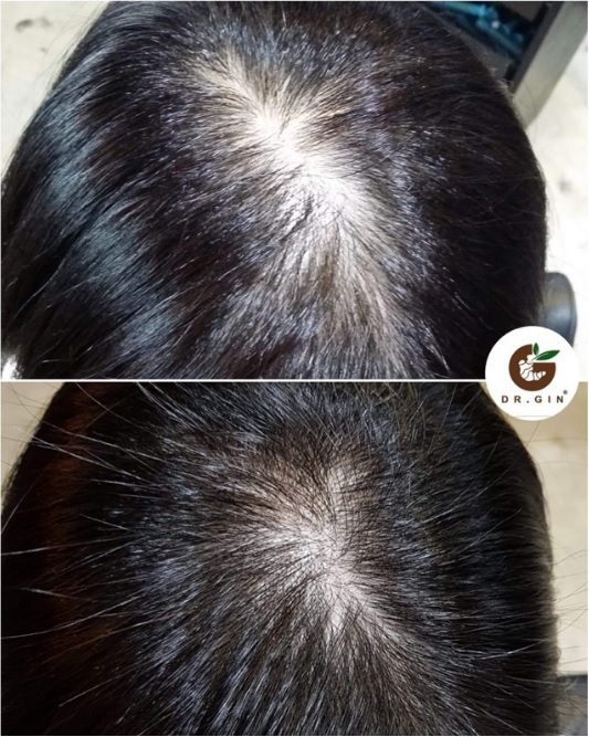 SL16] Dr Gin Ginger Root Booster Shampoo 400ml Anti Hair Fall | Shopee  Malaysia