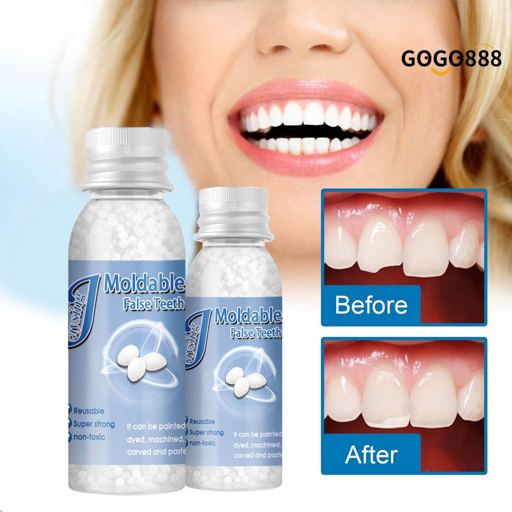 Eelhoe False Teeth Adhesive Glue Teeth Whitening Glue Gaps Improve Oral