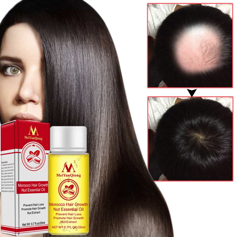 Hair Care Essential Oil Essence Prevention Hair Loss Moisturizes