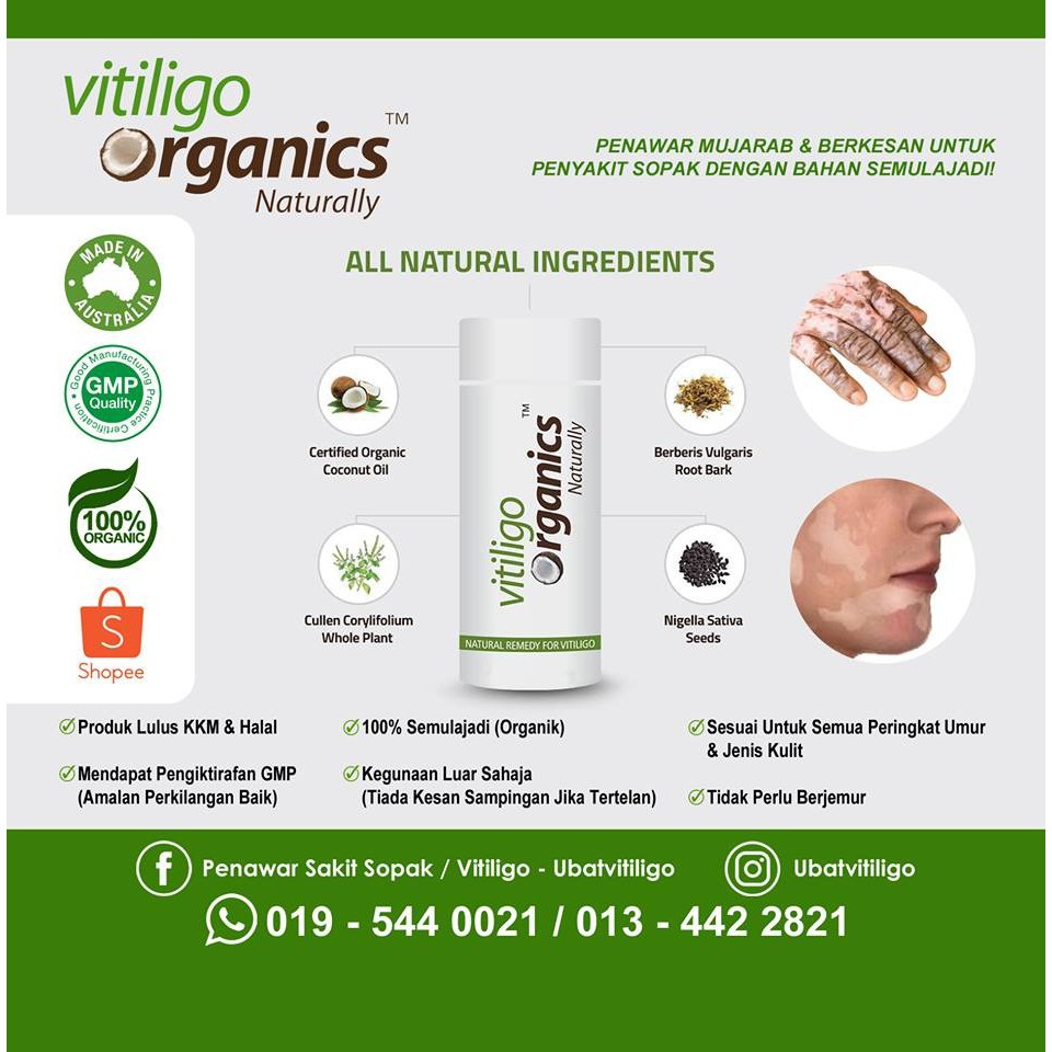Vitiligo Organics Naturally Penawar Ubat Penyakit Sakit 