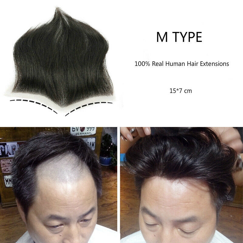 Mens Toupee Forehead Hairline Real Human Hair Replacement Poly