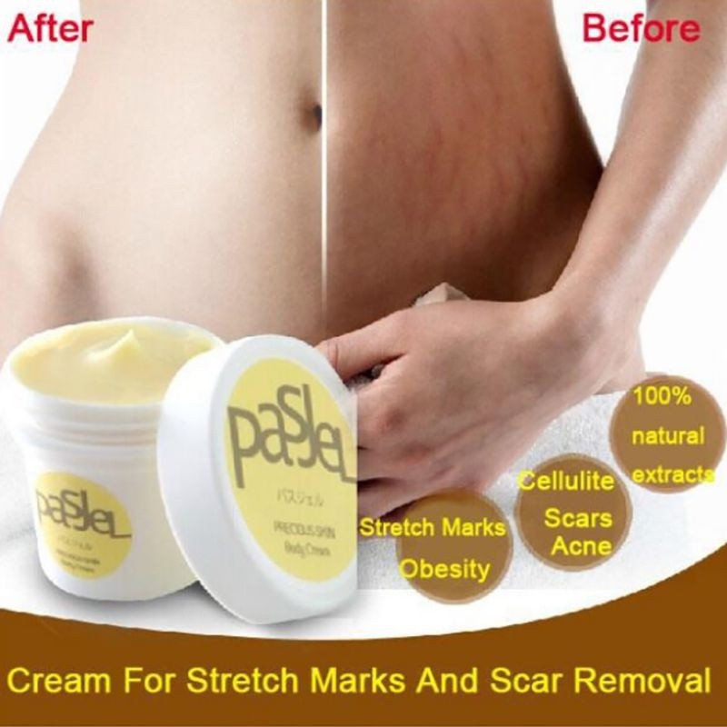 pregnancy-scar-removal-repair-cream-stretch-marks-scar-removal-scar