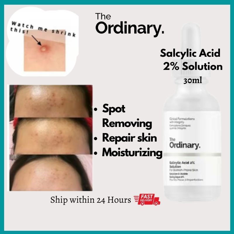 The Ordinary Salicylic Acid 2 Solution 30 Ml Shopee Malaysia 9735