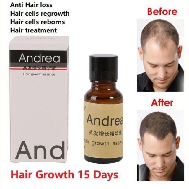 Grow Your Hair And Confidence Back Andrea Hair Treatment Hair
