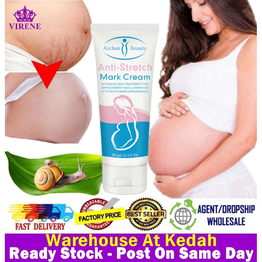 aichun stretch mark cream