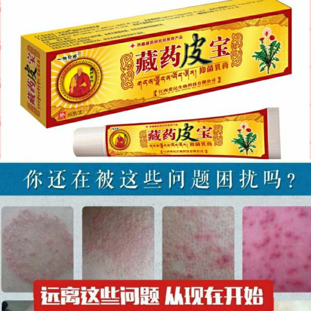 🔥现货💯%Eczema treatment Anti bacterial skin fungus cream 藏药皮 