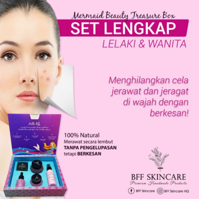 Mermiad beauty treasure box (jerawat)