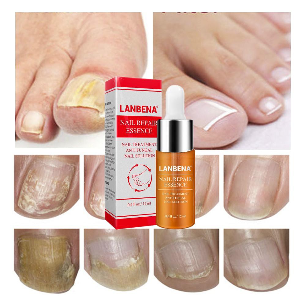 LANBENA Nail & Cuticle Care Essence Fingernail Repair Pedicure Manicure ...