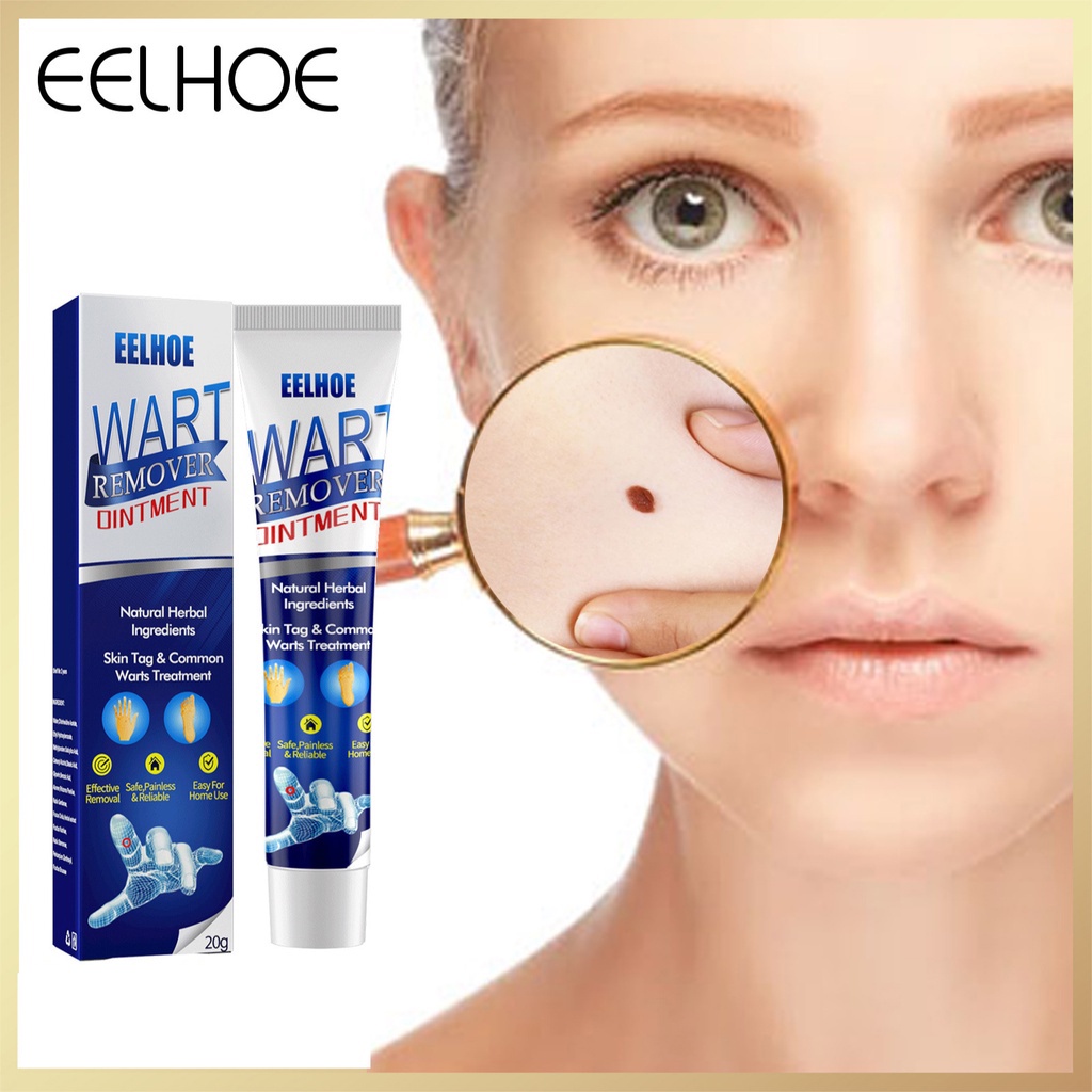 EELHOE Wart Removal Body Warts Treatment Cream Skin spot Tag Remover ...