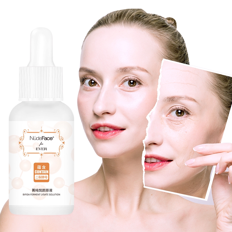 bifida ferment lysate acne