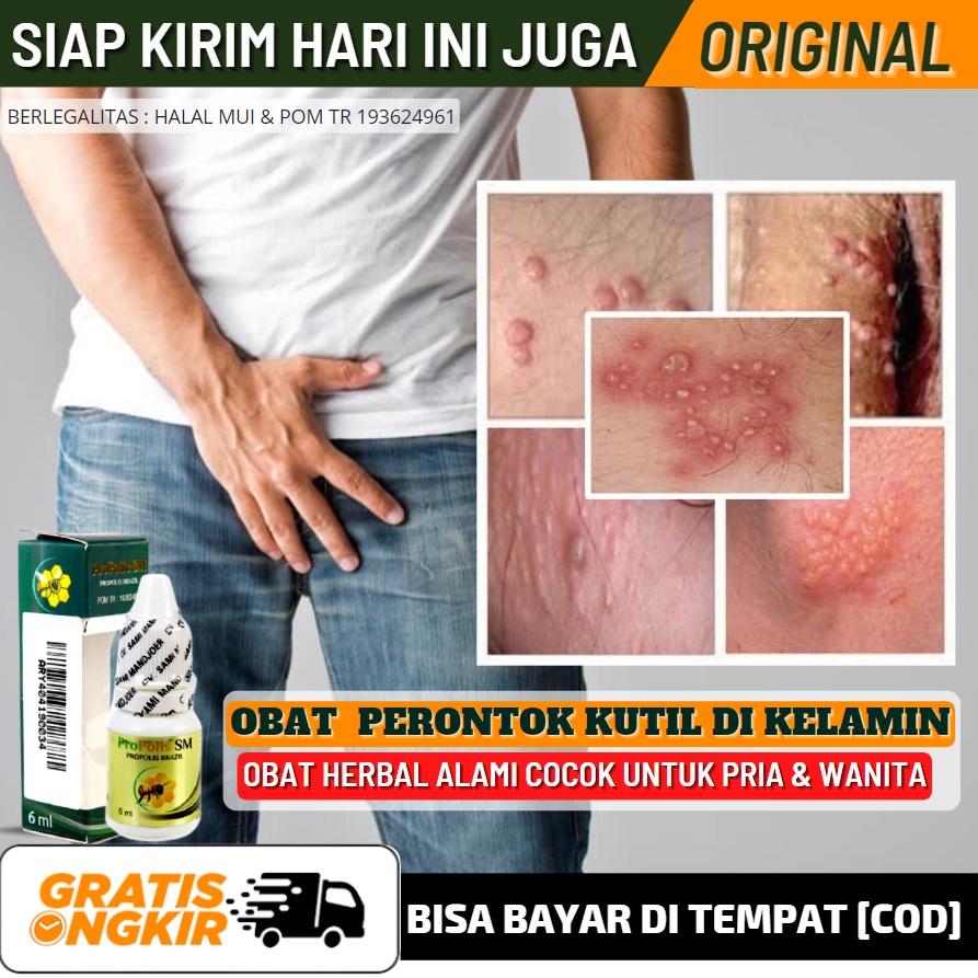Medicine Disease For Men / Women HPV Wart Medicine For Men & Women