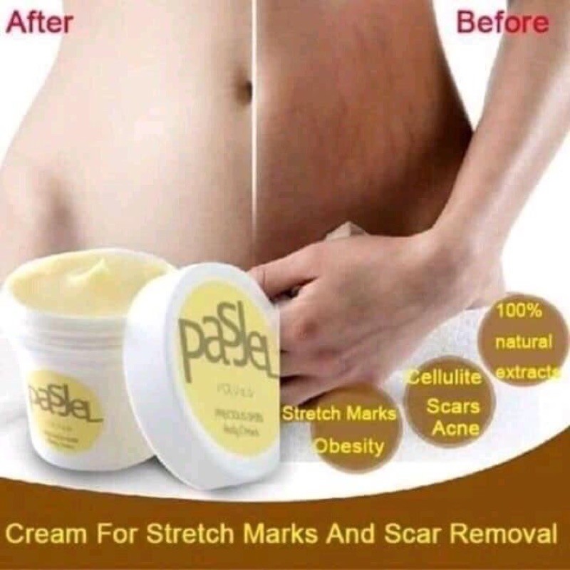 original pasjel stretch mark cream