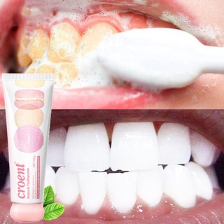 Teeth whitening Oral care Whitening toothpaste to remove yellow teeth and smoke stains Fresh breath 100g