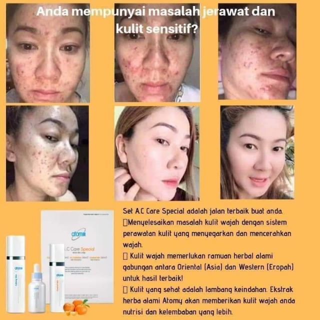 atomy skin care for combination skin