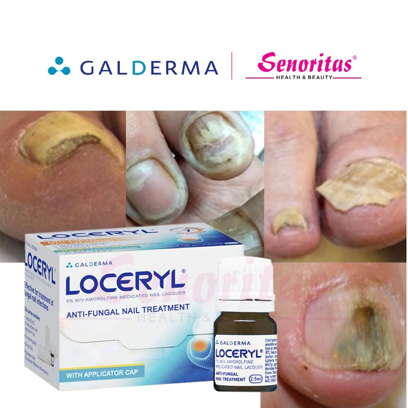 GALDERMA Loceryl 5 AntiFungal Nail Treatment (2.5ml) Shopee Malaysia