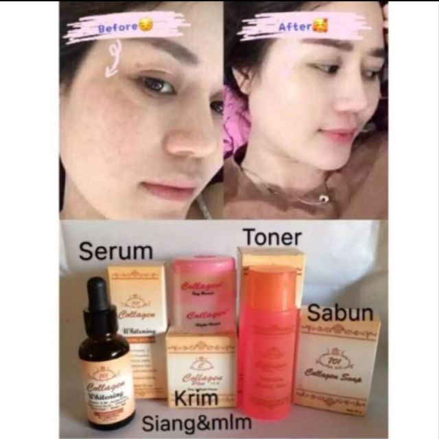 Ready Stock Original Indonesia 4in1 Full Set Collagen Plus Vitamine Original Krim Toner 60ml Shopee Malaysia