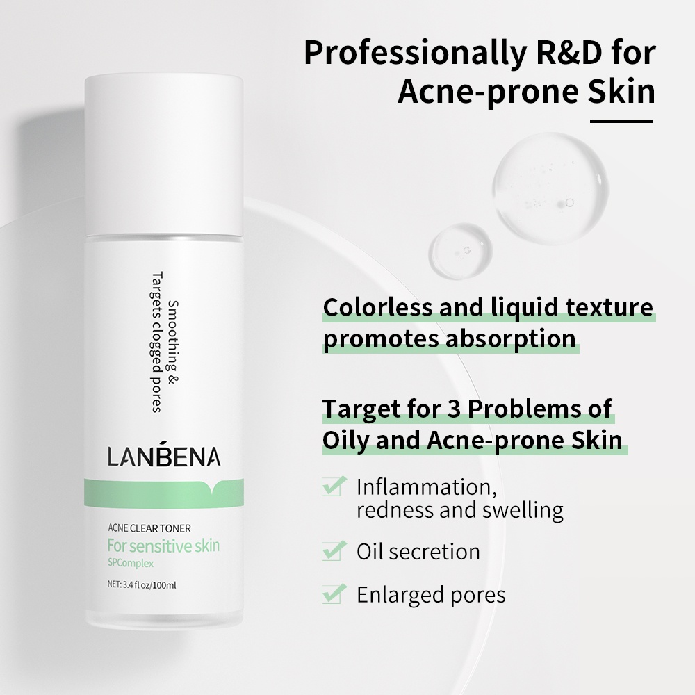 LANBENA Acne Treatment Facial Toner Soothe Skin Control Oil Shrink Pores Suitable for Acne-Prone Skin (100ml)