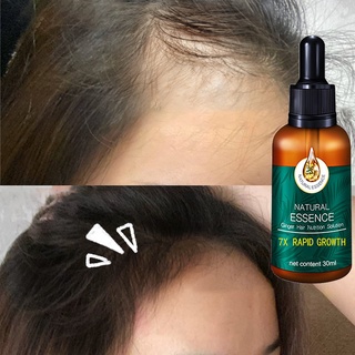 Ginger hair care essential oil Improve hair quality Hair growth essence  Scalp care, repair hair, prevent hair loss | Shopee Malaysia