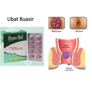 [TERBARU!] Ubat Kapsul Buasir Muqmeen Herbs (40 kapsul 