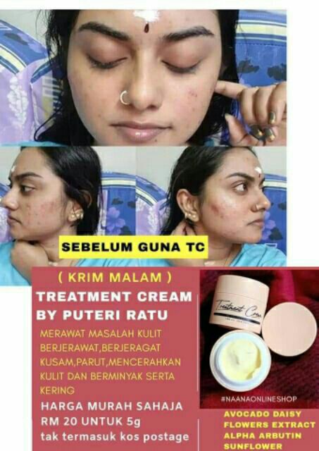 Set Krim Siang Dan Malam Untuk Masalah Jeragat Jerawat Dan Kulit Kusam Shopee Malaysia