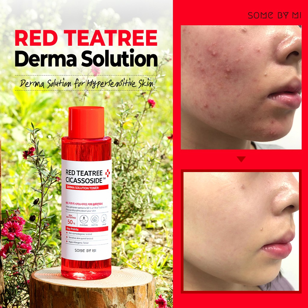 some by mi red teatree cicassoside derma solution toner