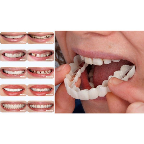Teeth Whitening Teeth Cover Perfect Smile Comfort Fit Flex Teeth