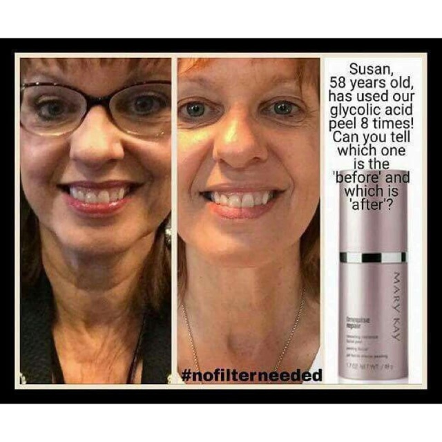 mary kay facial peel