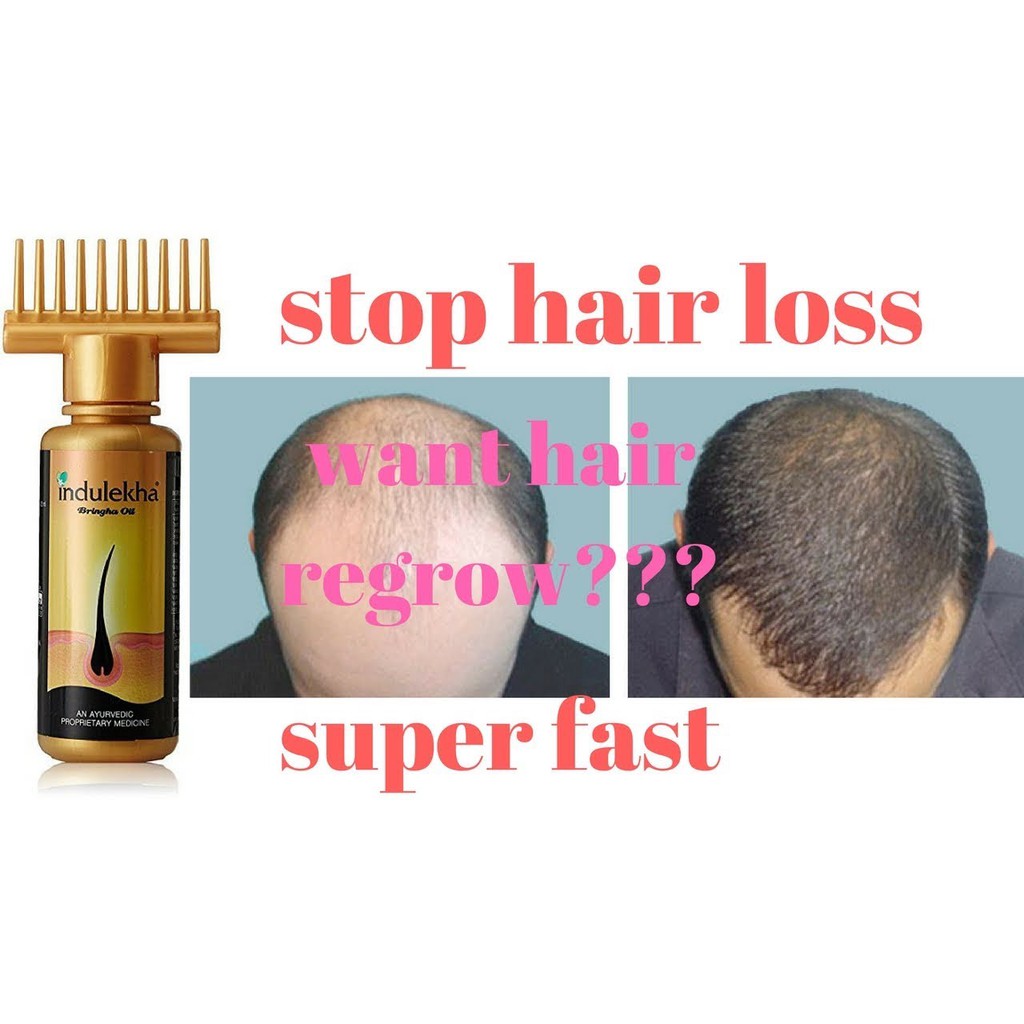 Indulekha Bringha Hair Oil Selfie Bottle, 100ml - Home Remedy for Hair Fall  | Shopee Malaysia