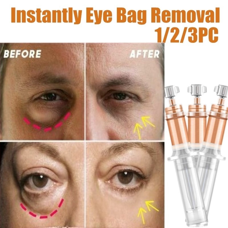 best instant eye bag removal cream