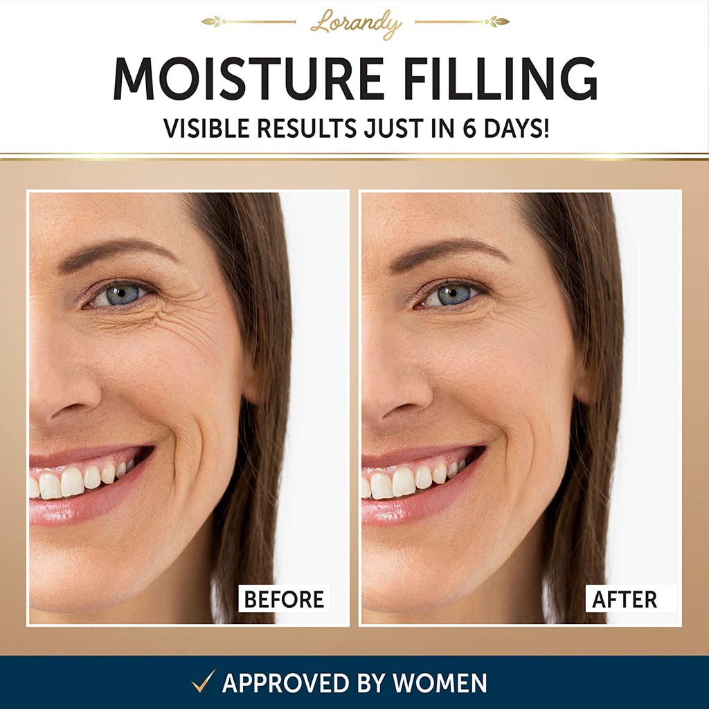 lorandy night cream