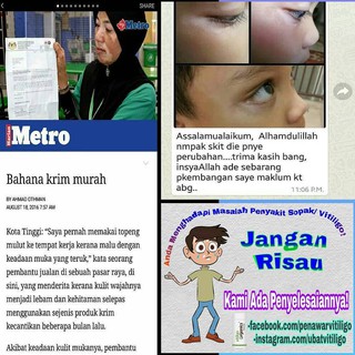 Vitiligo Organics Naturally Penawar Ubat Penyakit Sakit 