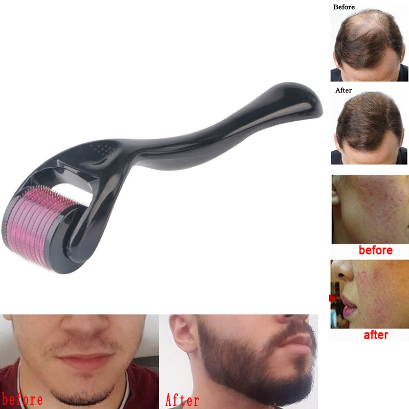 DRS 540 Derma Roller Facial Skin Care Micro Needle Therapy Skin Tool Skin  care scar acne hair re-growth beard growth Regrowth Anti Hair Loss  Treatment Thinning Receding 10sizes    